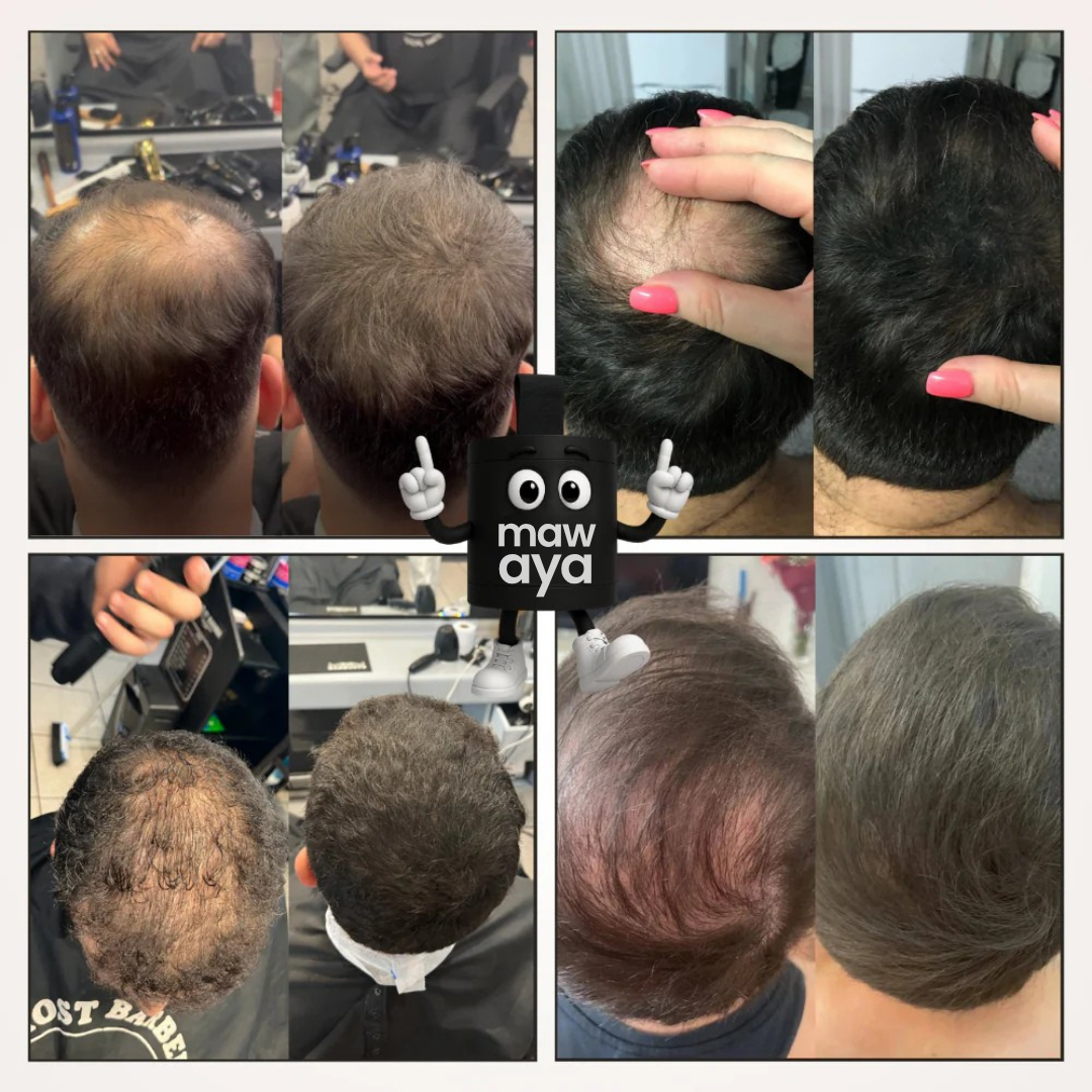Camuflaje capilar - OFERTA CLIENTE VIP